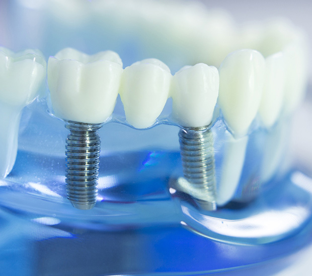 Brighton Dental Implants