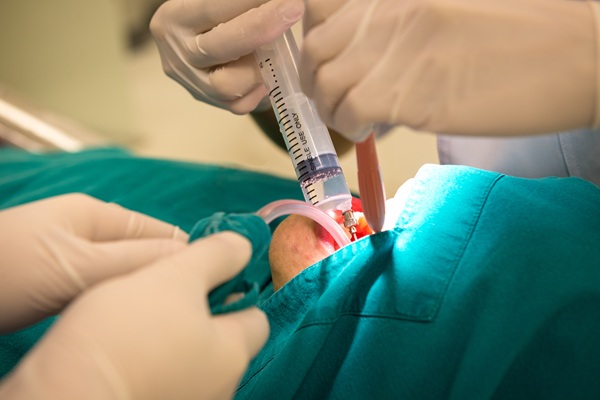 Common Types Of Jaw Surgery