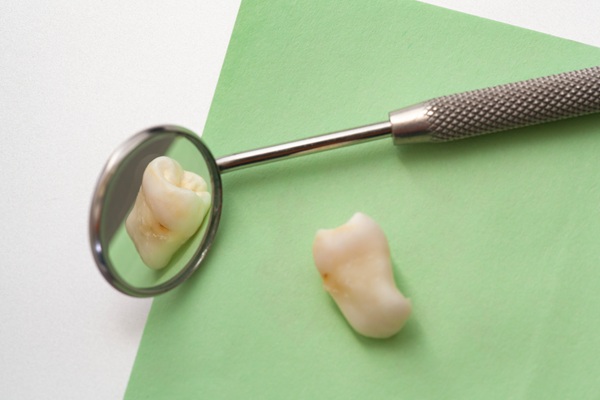 When Are Surgical Tooth Extractions Necessary? Key Signs To Know