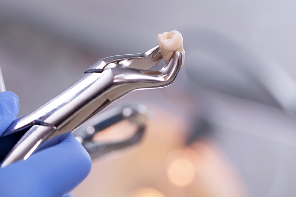 What To Know Before Getting Wisdom Teeth Extractions